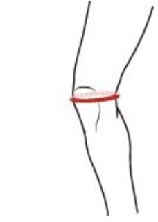 Afbeelding knie in een hoek van 45 graden om te bepalen voor meten McDavid kniebeschermers